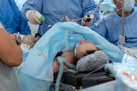 Operating room in the hospital. Endoscopy. Woman at the surgical table. A team of surgeons using endo-instruments operate the patient's abdomen. Surgery on the body of a full woman. Endovideosurgery.の写真素材