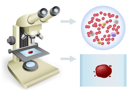 Analysis of blood under a microscope on a white background, two viewsのイラスト素材