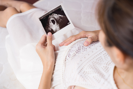Pregnant asian woman looking at ultrasound scan of baby and touching her belly, close up of scanの写真素材
