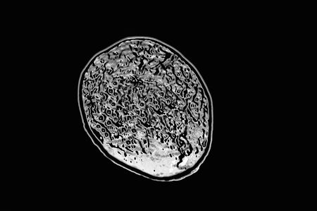 brain scan on black backgroundの写真素材