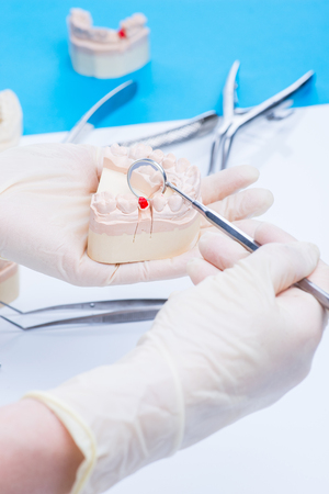 Doctor examinates the teeth mold