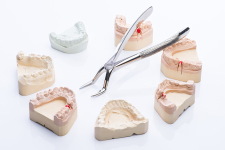 Teeth molds with basic dental tools on a bright white surface