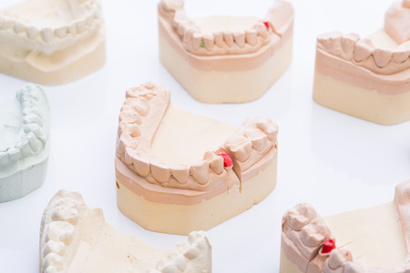 Teeth molds on a bright white surface