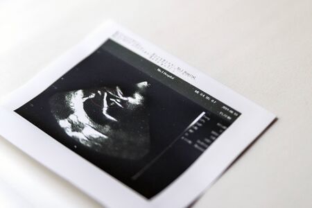 Image of Heart ultrasound with health danger printed on paper.