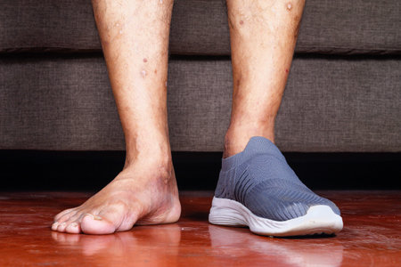 Close-up of a person's legs, one wearing a grey shoe and the other bare, standing on a wooden floor indoors, showcasing footwear and skin details in a casual environment.の写真素材