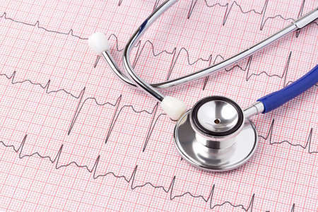 Photo of an electrocardiogram ECG or EKG printout with stethoscopeの写真素材