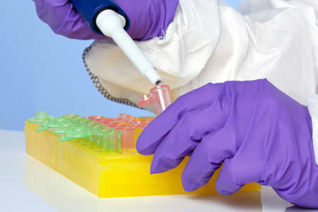 Photo of a lab technicians hands using a pipette