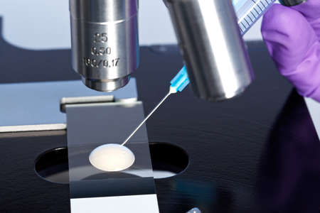 Photo of a sperm sample on a microscope slide with a syringe being used to extract an embryology specimen for analysis.の写真素材