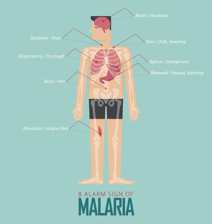 Alarm signs of Malaria infographic in flat design. Malaria disease symptom icon set  with human body, skeleton and organ. Vector Illustration.のイラスト素材