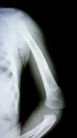 arm tomography