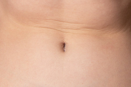 Woman belly with folds. Perfect body shape. Parts of a female bodyの写真素材