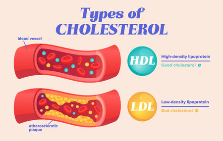 Types of cholesterol comparison with HDL and LDLのイラスト素材