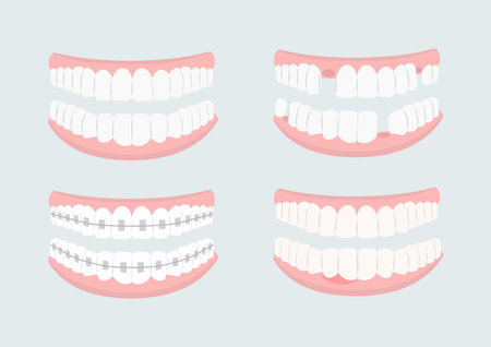 Set of teeth vectorのイラスト素材