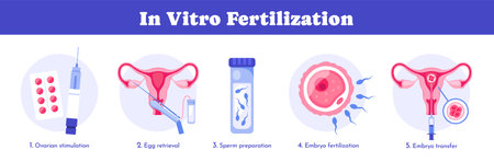In vitro fertilization. Medical poster with Embryo development stages and transfer. Detailed infographic showing laboratory fertilization. Flat vector illustration collectionのイラスト素材