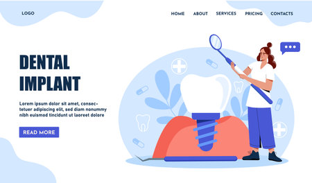 Dental implant healthcare concept.. Vector illustrationのイラスト素材