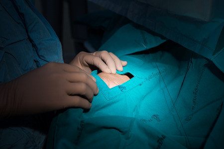 BANGKOK,Thailand-February:16, 2015:The doctor and staff are treating with Angiography,this is a medical imaging technique used to visualize the inside of blood vesselsのeditorial素材