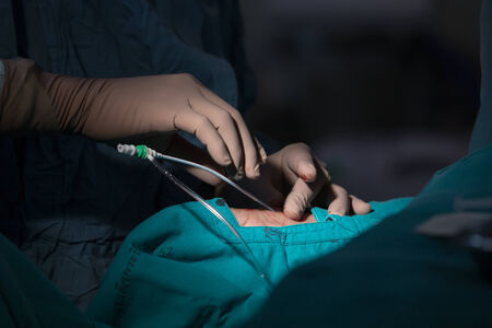 BANGKOK,Thailand-February:16, 2015:The doctor and staff are treating with Angiography,this is a medical imaging technique used to visualize the inside of blood vesselsのeditorial素材