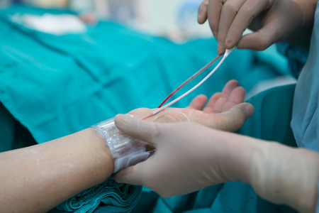 BANGKOK,Thailand-February:16, 2015:The doctor and staff are treating with Angiography,this is a medical imaging technique used to visualize the inside of blood vesselsのeditorial素材