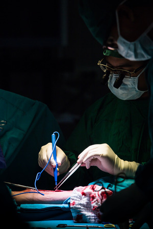 BANGKOK,Thailand-march:31, 2015:The doctor and staff are treating with open heart cardiac bypass surgery in full operation roomのeditorial素材