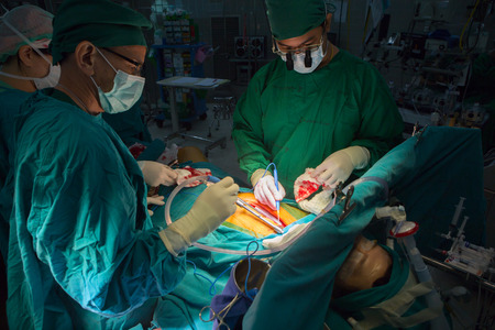 BANGKOK,Thailand-march:31, 2015:The doctor and staff are treating with open heart cardiac bypass surgery in full operation roomのeditorial素材