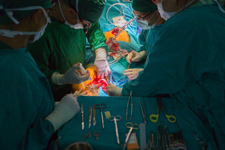 BANGKOK,Thailand-march:31, 2015:The doctor and staff are treating with open heart cardiac bypass surgery in full operation roomのeditorial素材