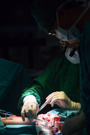 BANGKOK,Thailand-march:31, 2015:The doctor and staff are treating with open heart cardiac bypass surgery in full operation roomのeditorial素材