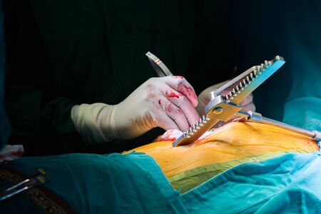 Surgery for Coronary Artery Bypass Grafting: CABG