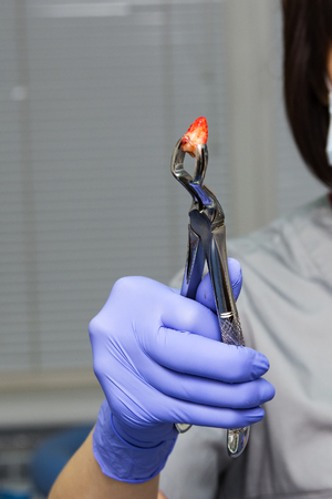 Pulled tooth in the metallic forceps and little blood on tooth. Dentist's hand in the rubber medical blue glove with the forceps. just extracted toothの写真素材
