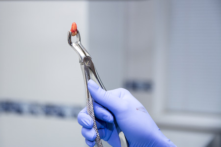 Pulled tooth in the metallic forceps and little blood on tooth. Dentist's hand in the rubber medical blue glove with the forceps. just extracted toothの写真素材