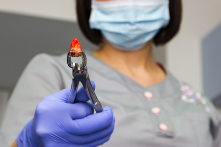 Pulled tooth in the metallic forceps and little blood on tooth. Dentist's hand in the rubber medical blue glove with the forceps. just extracted toothの写真素材