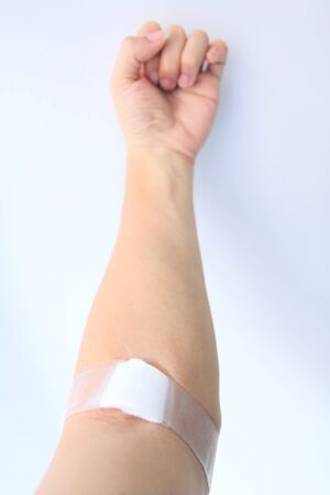 wound after blood donationの写真素材