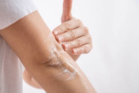 Beauty and Body care. Female elbow. Pain and health care concept.の写真素材