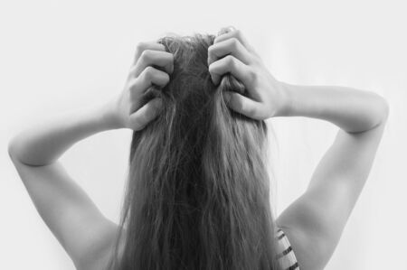 Closeup woman hand itchy scalp, Hair care conceptの写真素材