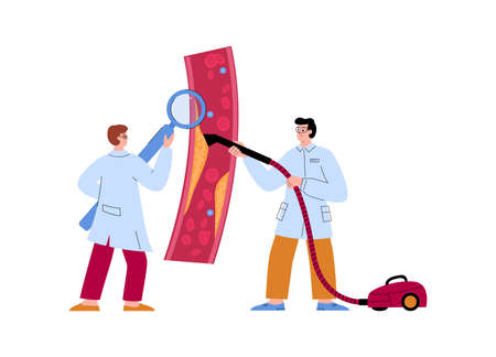 Cleansing vessels and veins from cholesterol or blood clot, flat vector isolated.のイラスト素材