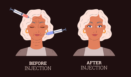Before and after woman beauty facial correction injection, cosmetology, anti-aging skin care vector infographic on darkのイラスト素材