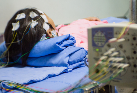 Blurred of patient with encephalography electrode. Electroencephalogram,EEGの写真素材