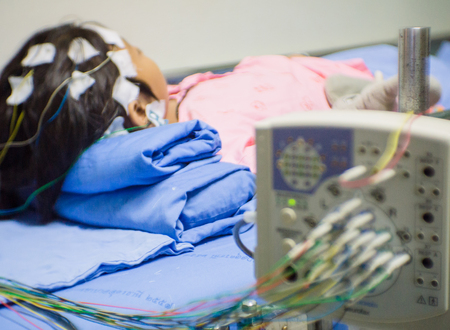 Blurred of patient with encephalography electrode. Electroencephalogram,EEGの写真素材