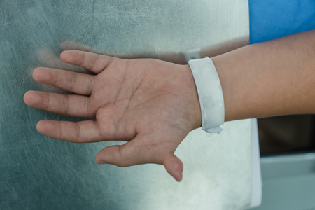 Polydactyly,disorders of hand,six fingers in one hand.の写真素材