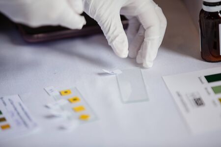 Process of hematocrits test in laboratory.