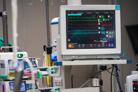 Vital signs monitor with machines during surgery on a patient in operating room.の写真素材