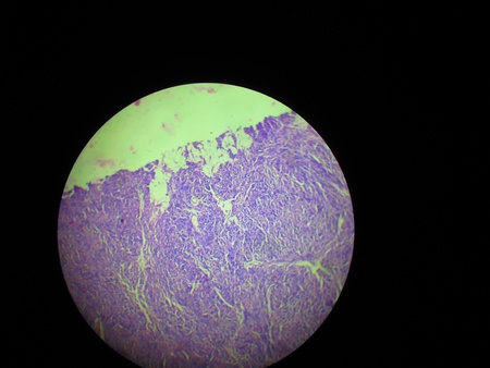 Blood cell under microscopeの写真素材