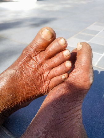 A closeup shot of rough feet of an elderly woman in India