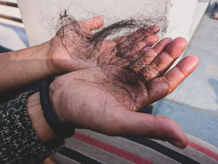 Handful of fallen hairs after combing in men, showcasing rising baldness and hair fall in young adults with alopecia in India.の写真素材