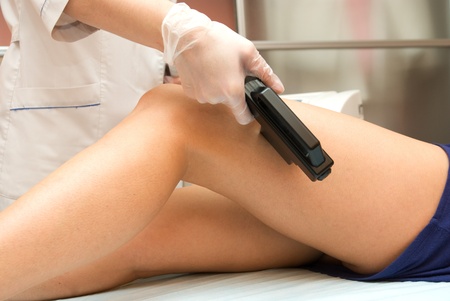 Laser epilation of leg in a modern beauty shopの写真素材