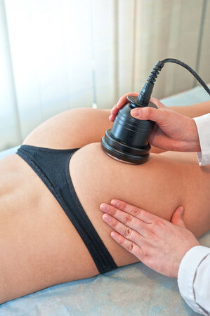 procedure for women hip for cellulite and fatの写真素材