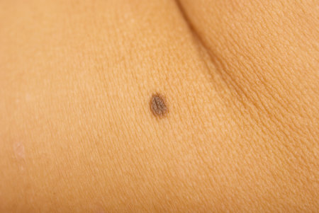 close up of moleの写真素材