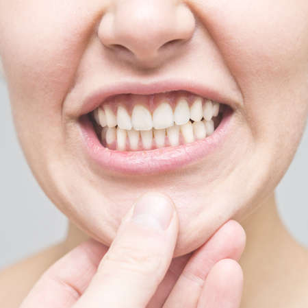 checking the teeth