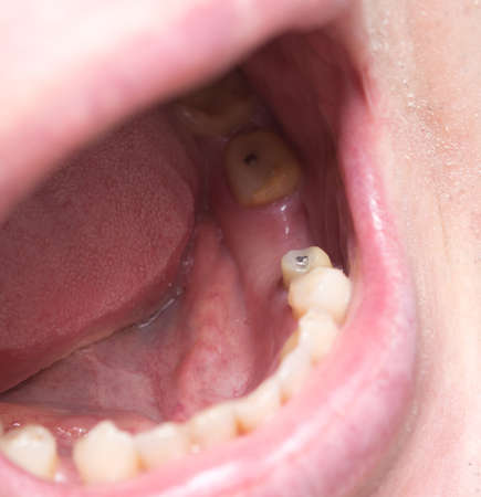 part of face, toothless