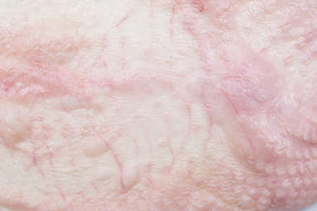 close up shot of chicken skin
