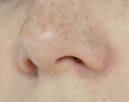 Close up shot of human nose